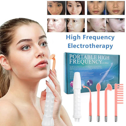 High Frequency Facial Wand for Skin Therapy & Acne Treatment - The Girly Things