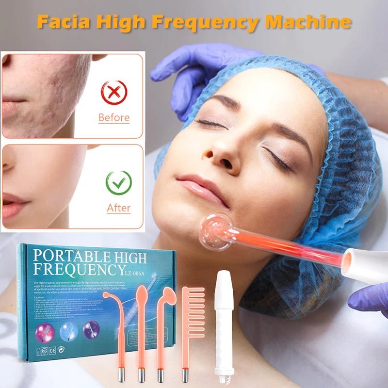 High Frequency Facial Wand for Skin Therapy & Acne Treatment - The Girly Things